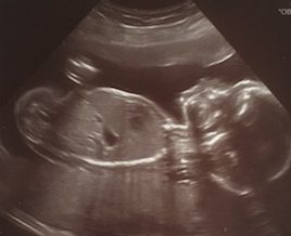 Baby boy Preston 